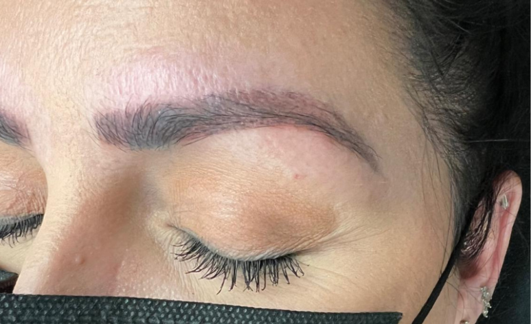 Before Microblading Removal Treatment