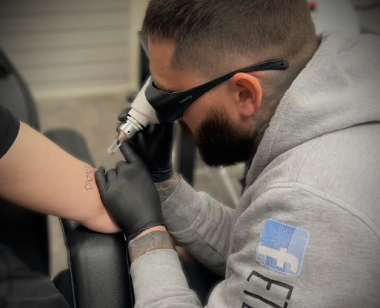 Jamie performing Laser Tattoo Removal Walsall