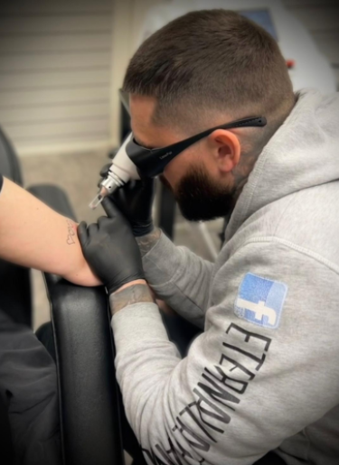 Jamie from Eternal Laser Studio Walsall performing laser tattoo removal