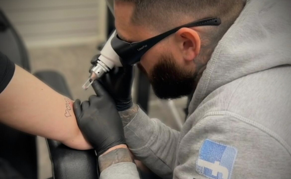Jamie from Eternal Laser Studio Walsall performing laser tattoo removal